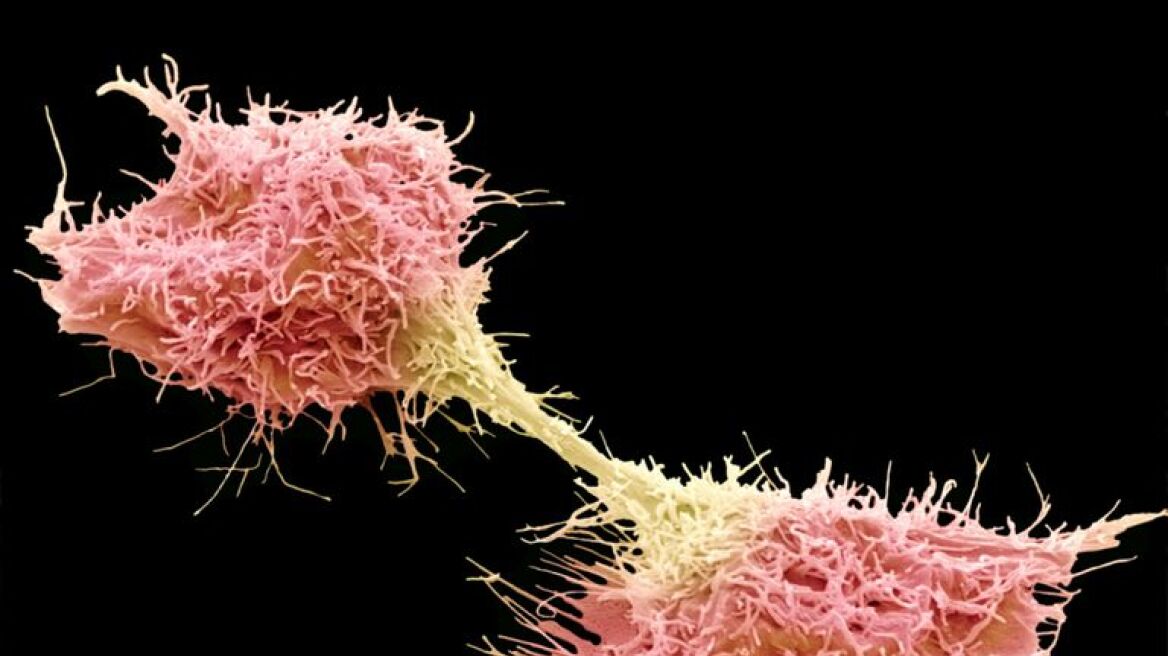 Μία έως δέκα μεταλλάξεις χρειάζονται για να ξεκινήσει ένας καρκίνος