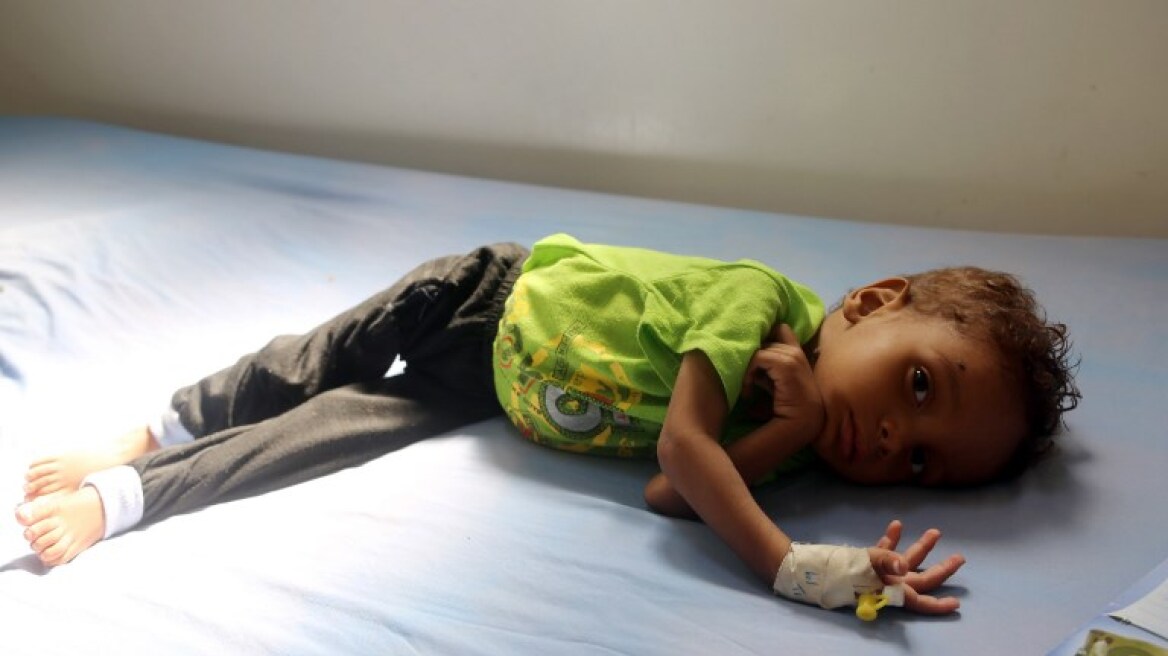 Φωτογραφίες-σοκ: Πώς η Σαουδική Αραβία διαλύει την Υεμένη - Παιδιά πεθαίνουν καθημερινά