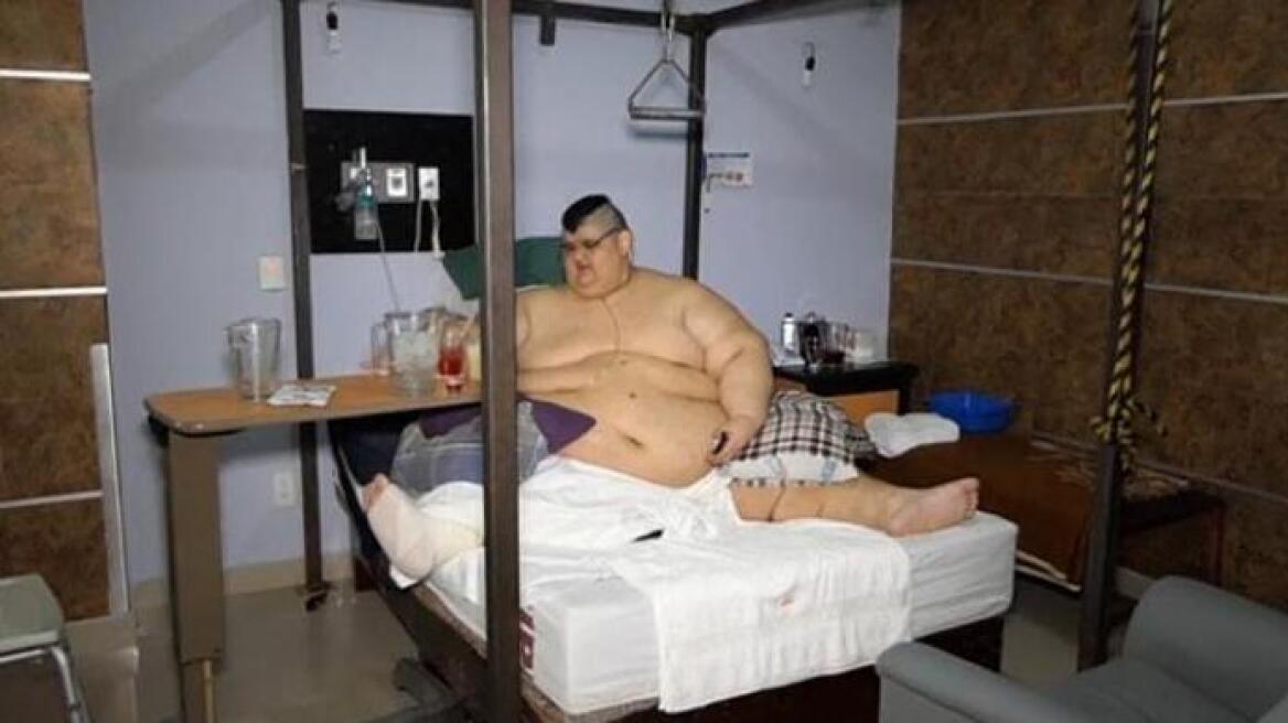 World’s heaviest man has surgery to halve weight (photo)