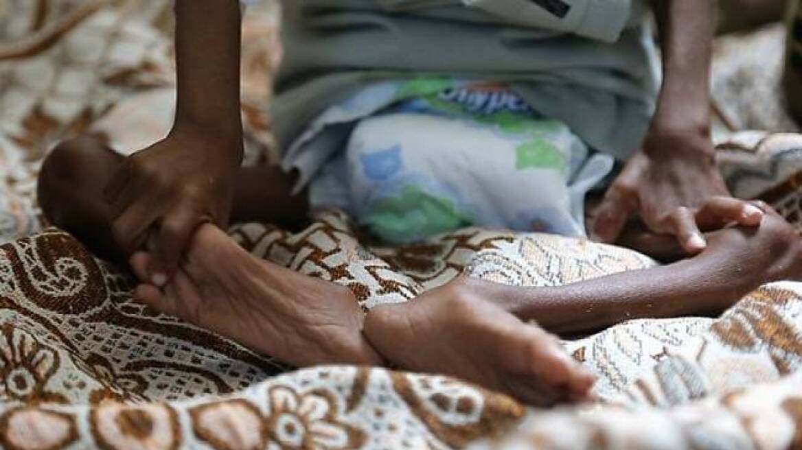«Καμπανάκι» ΟΗΕ: Ένα βήμα πριν τον λιμό πάνω από 8 εκατομμύρια άνθρωποι στην Υεμένη
