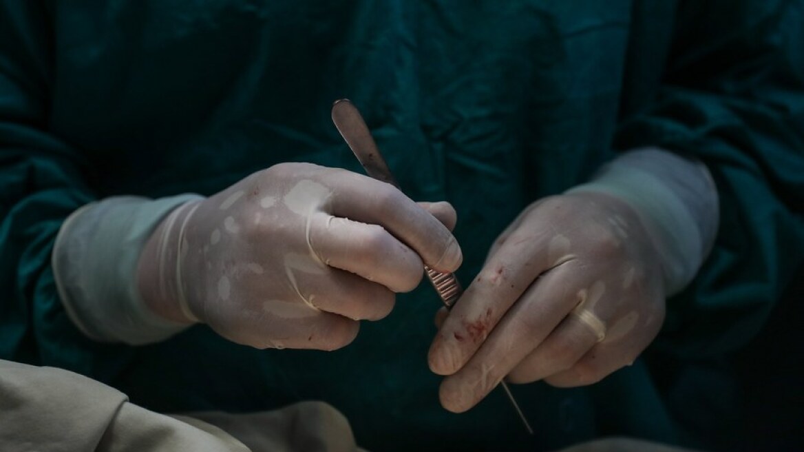 Βρετανός χειρουργός δικάζεται γιατί υπέγραψε με τα αρχικά του στο... συκώτι δύο ασθενών!