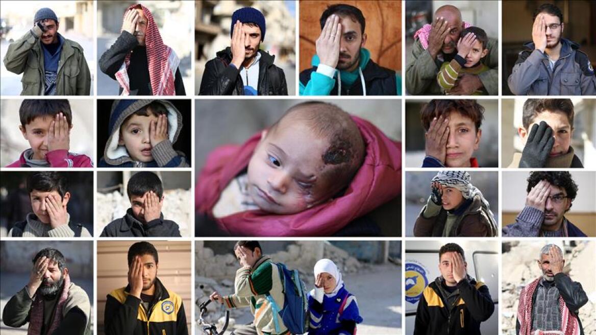 Μια εικόνα χίλιες λέξεις: Σύμβολο του πολέμου ο μικρός Καρίμ που έχασε το ένα του μάτι σε αεροπορική επιδρομή