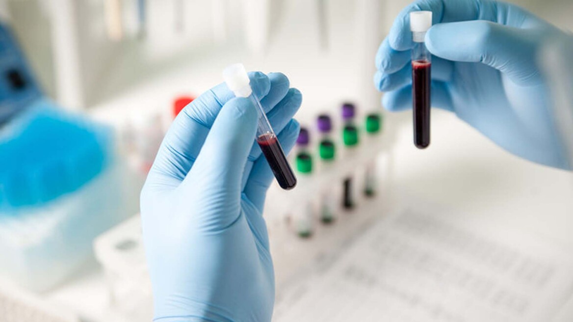 Απλό τεστ αίματος ανιχνεύει έγκαιρα την τοξική πρωτεΐνη της νόσου Αλτσχάιμερ