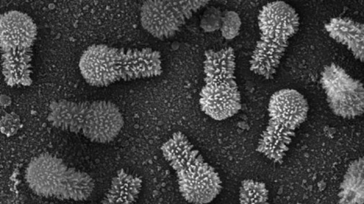 Ανακαλύφθηκαν δύο γιγάντιοι ιοί με τα περισσότερα γονίδια για δημιουργία πρωτεϊνών που έχουν βρεθεί ποτέ