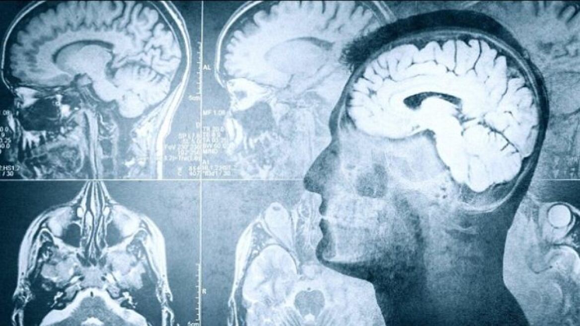 Τι συμβαίνει στον εγκέφαλο ένα λεπτό πριν το θάνατο