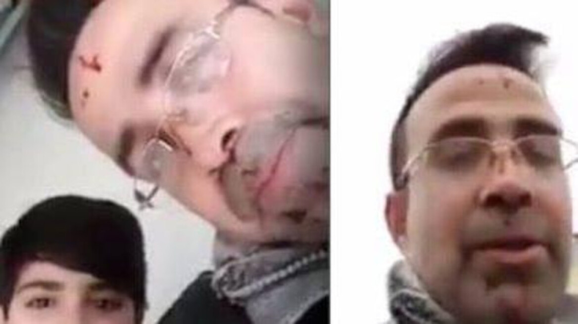 Αγριότητα: Σύρος πρόσφυγας έσφαξε τη γυναίκα του και μετά έκανε live στο Facebook