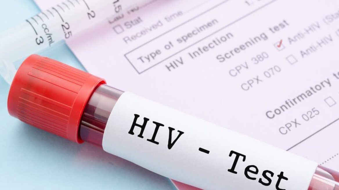 AIDS: Οι τρόποι μετάδοσης και πώς μπορεί να επηρεάσει μια σχέση 
