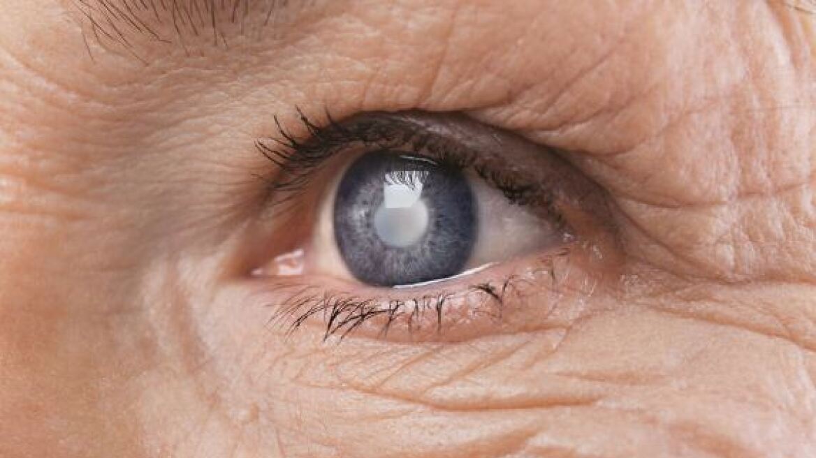 Θεραπεία βλαστοκυττάρων αποκατέστησε την όραση ηλικιωμένων ένα βήμα πριν την τύφλωση