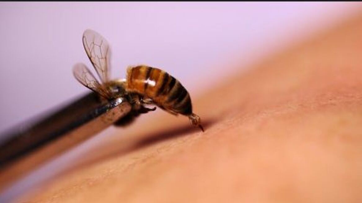 Νεκρή 55χρονη γυναίκα που υποβαλλόταν σε θεραπεία «βελονισμού» με... ζωντανές μέλισσες
