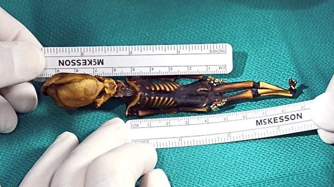 Λύθηκε το μυστήριο με τον σκελετό της Χιλής: Ο Άτα δεν είναι εξωγήινος αλλά κορίτσι