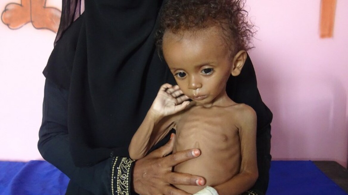 yemen-child-2