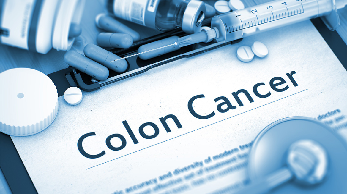 190610183604_colon_cancer
