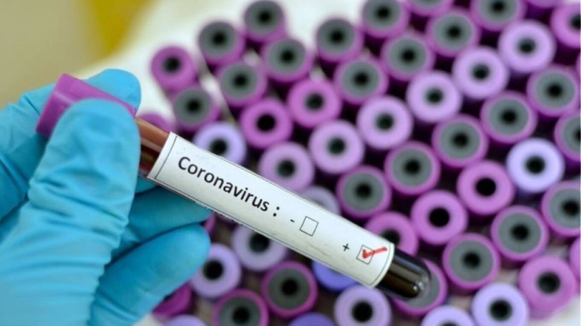 200226105929_coronavirus