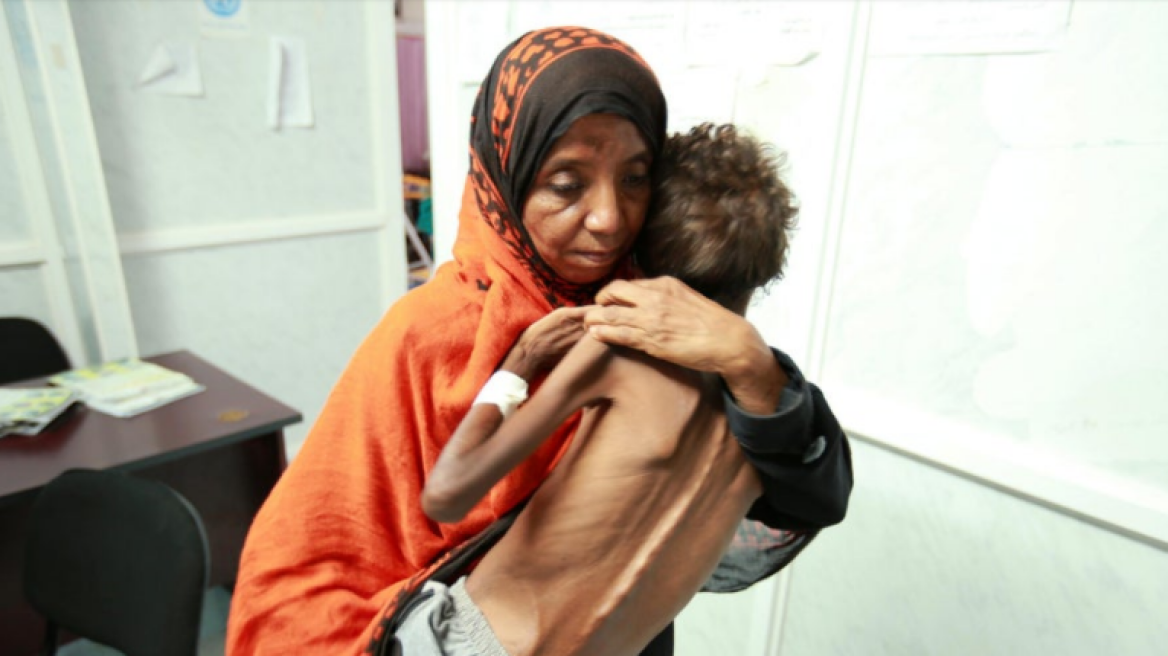 yemen_starvation