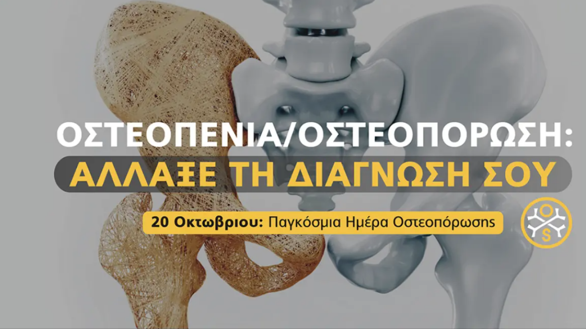 osteostrong-osteopenia-pagosmiaimeraosteoporosis