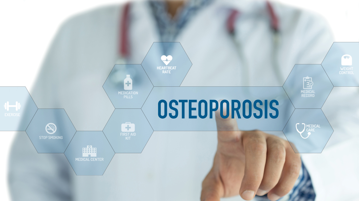 osteostrong-osteoporosis