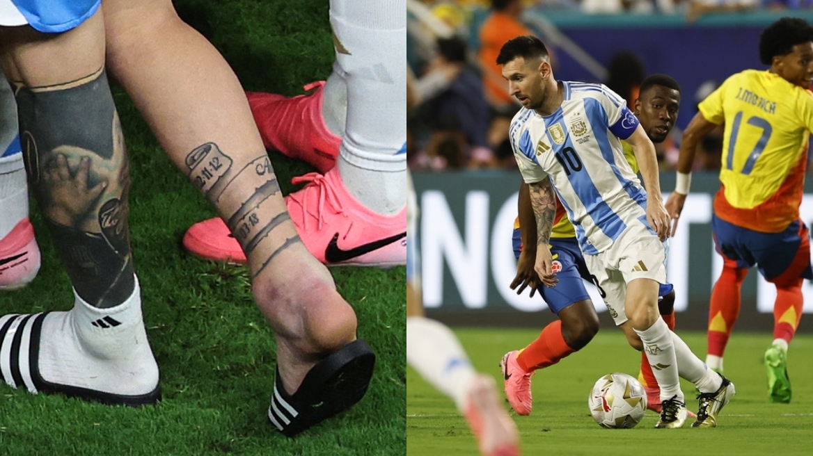 messi-ankle