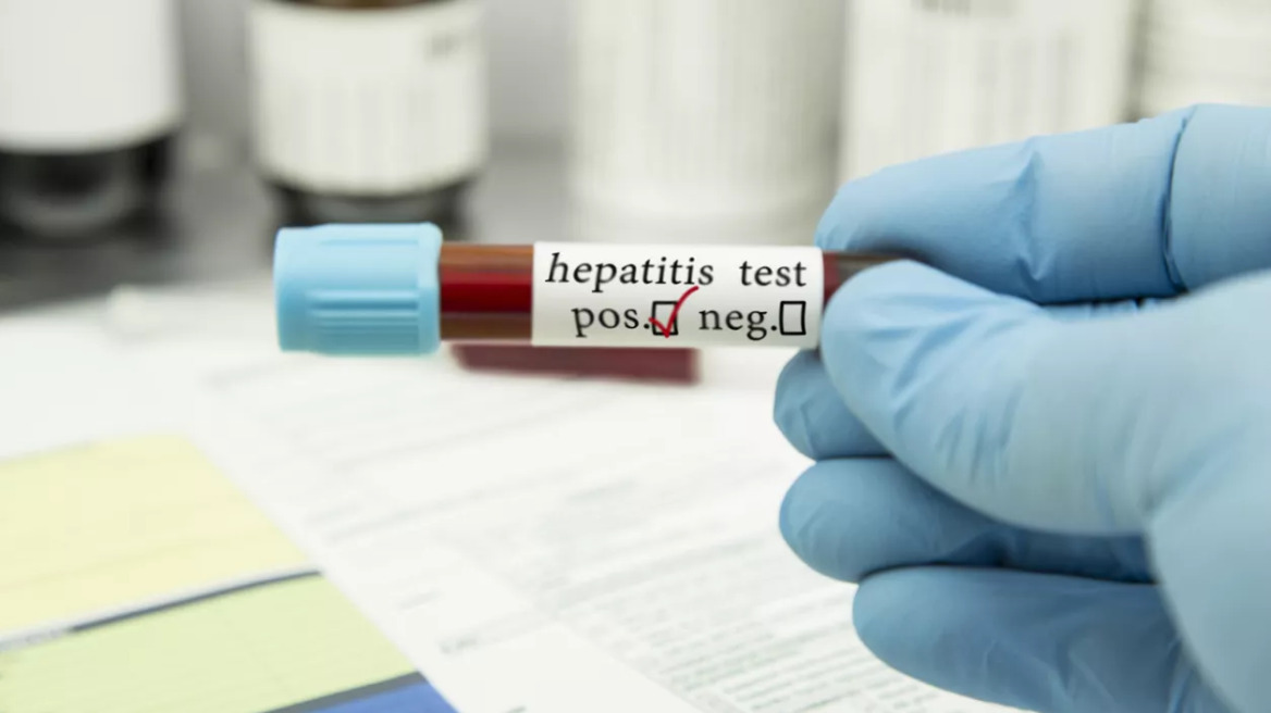 hepatitis_iStock-1211627427