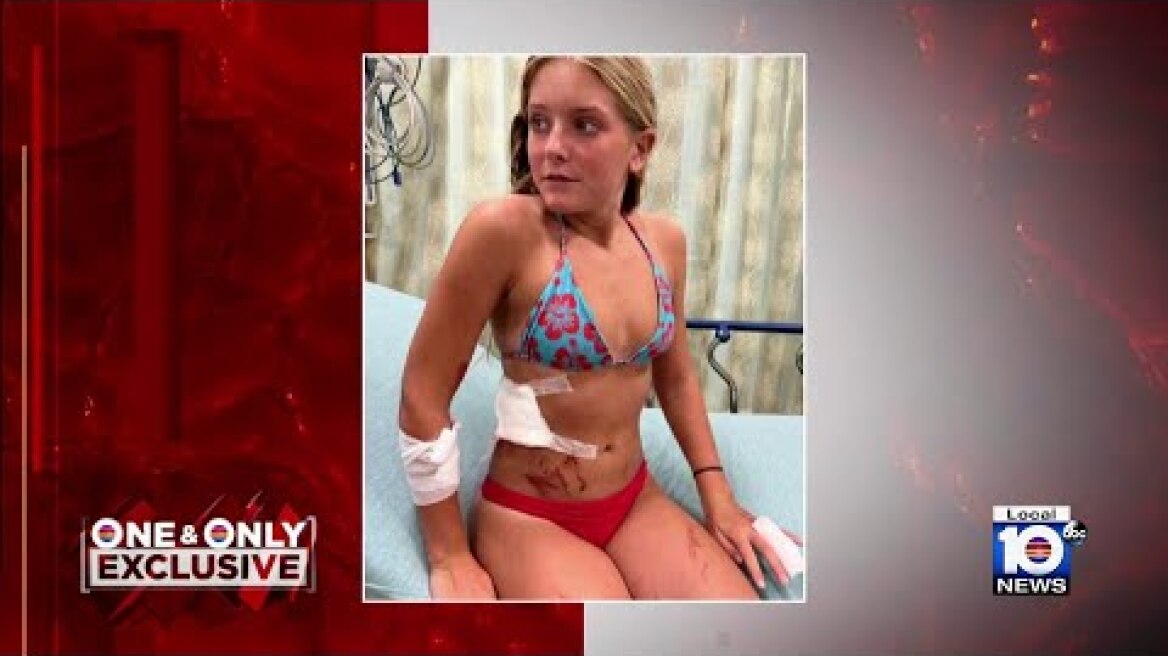 Brave Florida teen shares story with Local 10 News after being bit by shark multiple times