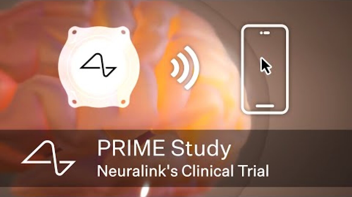 Neuralink's Clinical Trial: The PRIME Study