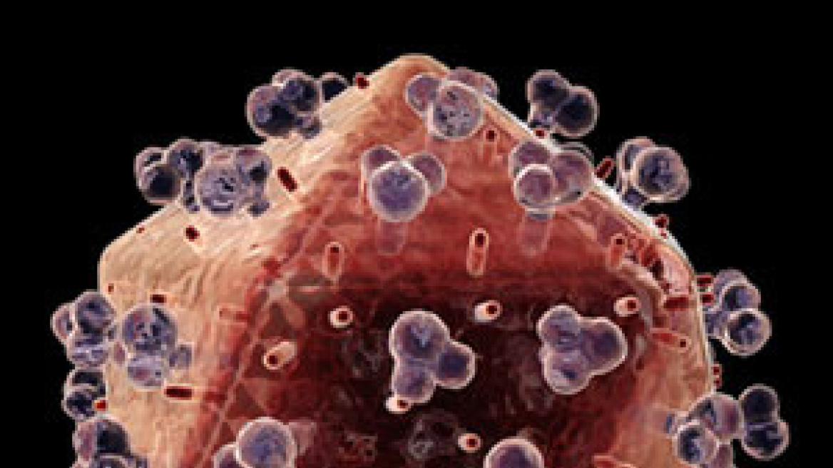 Μικροβιοκτόνο ζελέ μειώνει τον κίνδυνο μόλυνσης από HIV