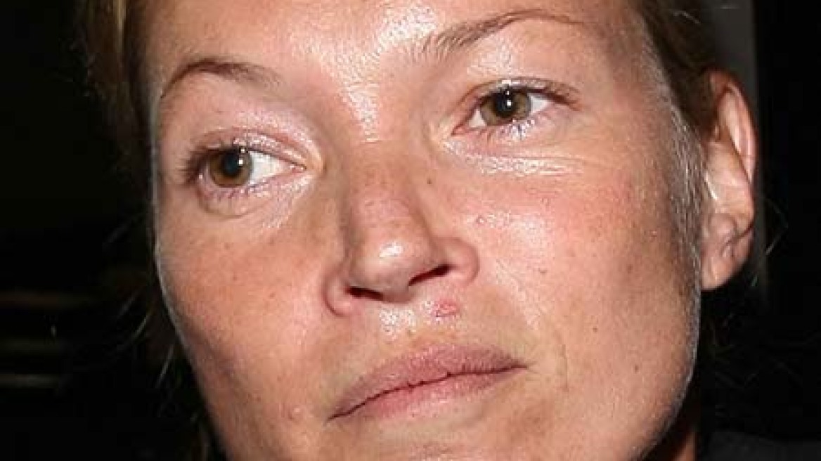 Χάλια χωρίς make-up η Kate Moss