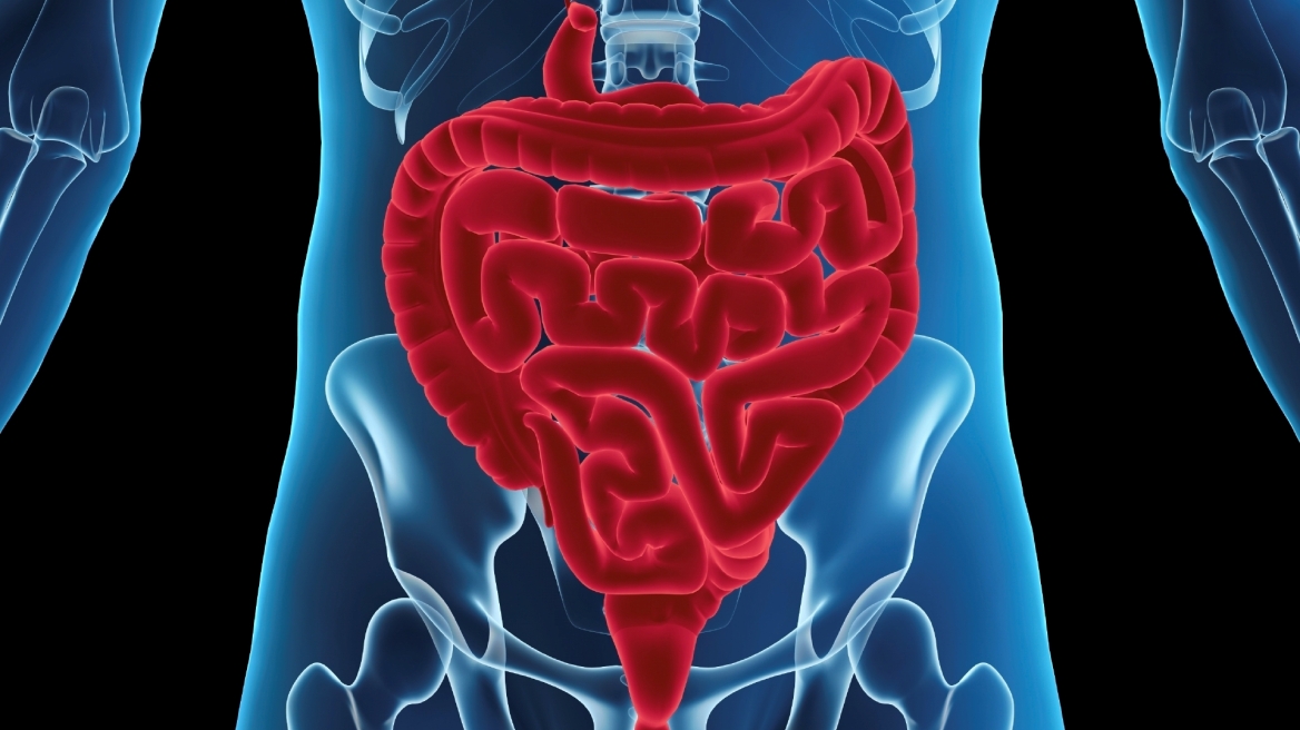 ΗΠΑ: Νέο αποτελεσματικό τεστ για τη διάγνωση του καρκίνου του εντέρου