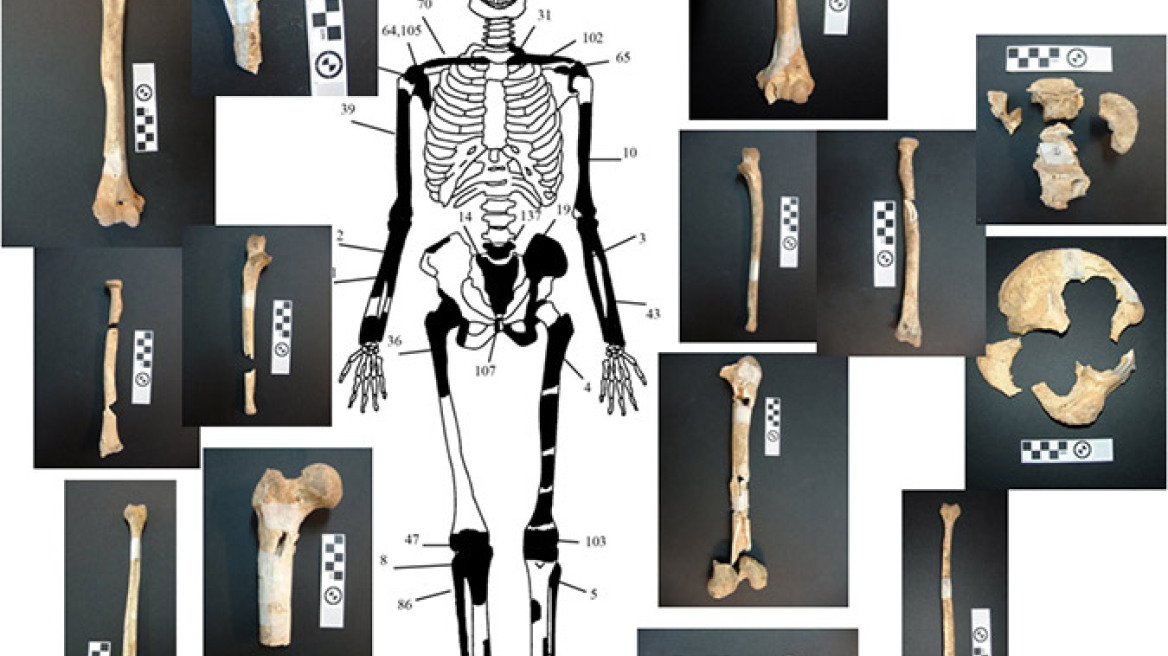 Αμφίπολη: Σε πέντε άτομα ανήκουν τα 550 οστά που βρέθηκαν στον τάφο 