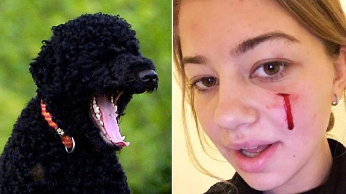 Obama’s dog attacks guest at White House (photos)