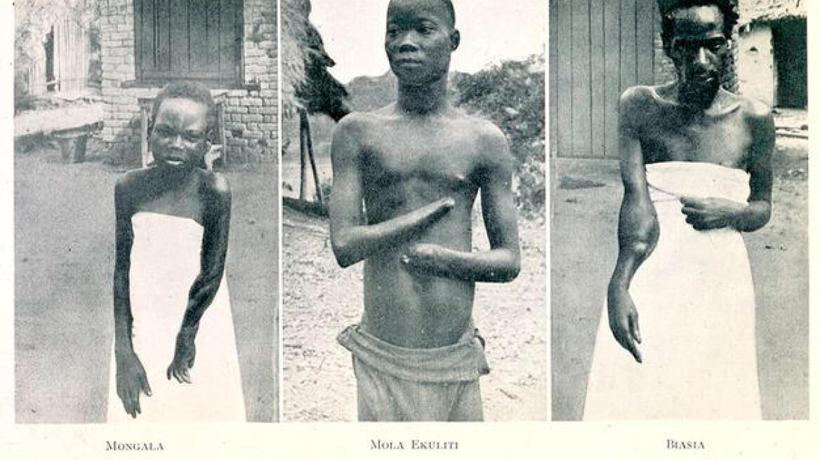 Meet King Leopold II of Belgium: The “Hitler of Congo” (PHOTOS)