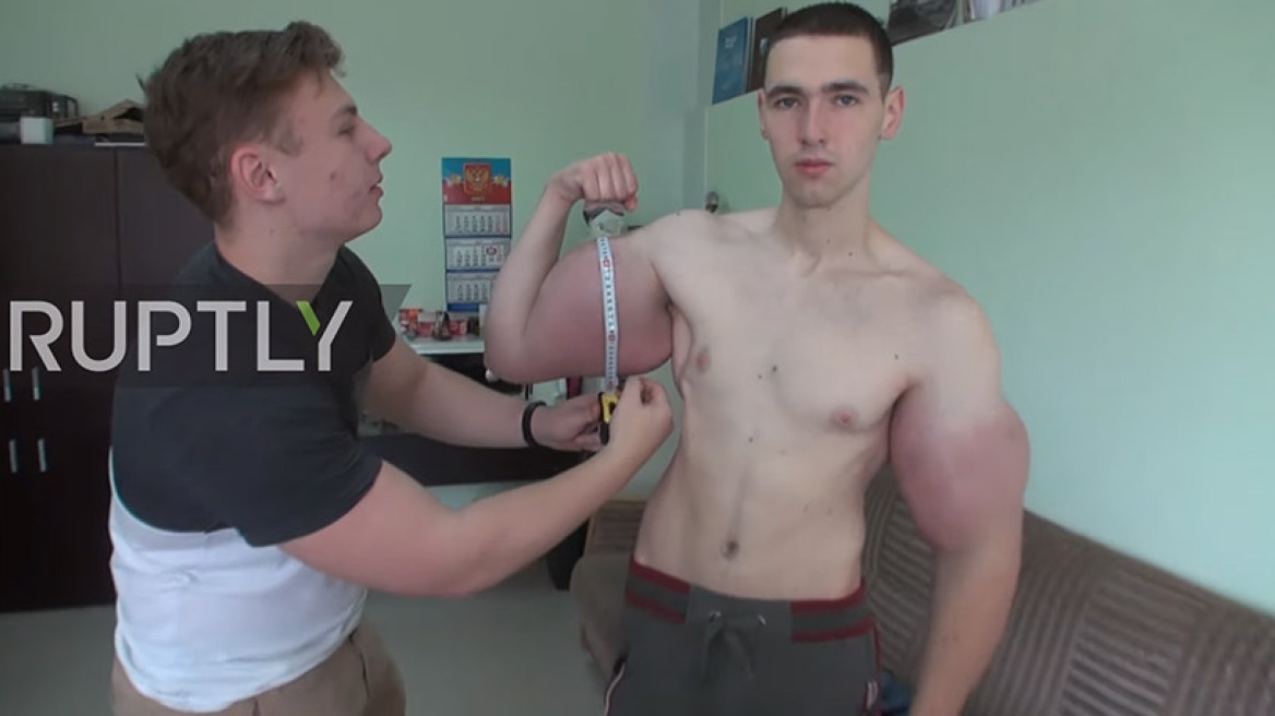   Ρώσος «Ηρακλής» έκανε ενέσεις και έφτιαξε δικεφάλους 64 εκατοστών