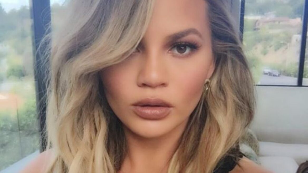 Η Chrissy Teigen αποκάλυψε την πλαστική επέμβαση που έκανε όταν ήταν μόλις 20 χρονών