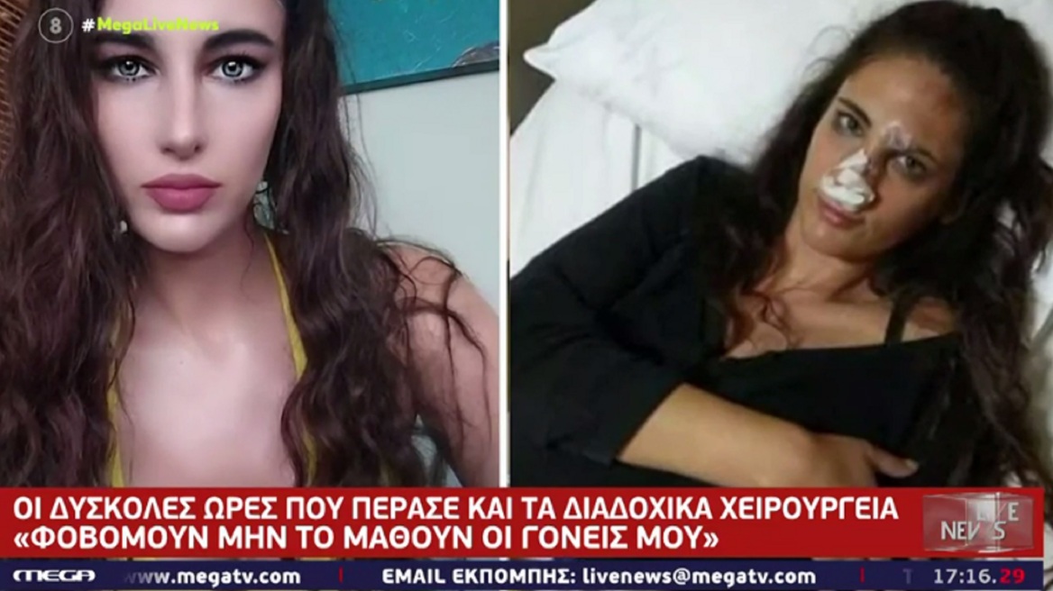 Η Ναστάζια Μητροπούλου μιλά για την κακοποίηση από πρώην σύντροφό της: Κόντεψα να μείνω παράλυτη, ήταν σπασμένη η μέση μου