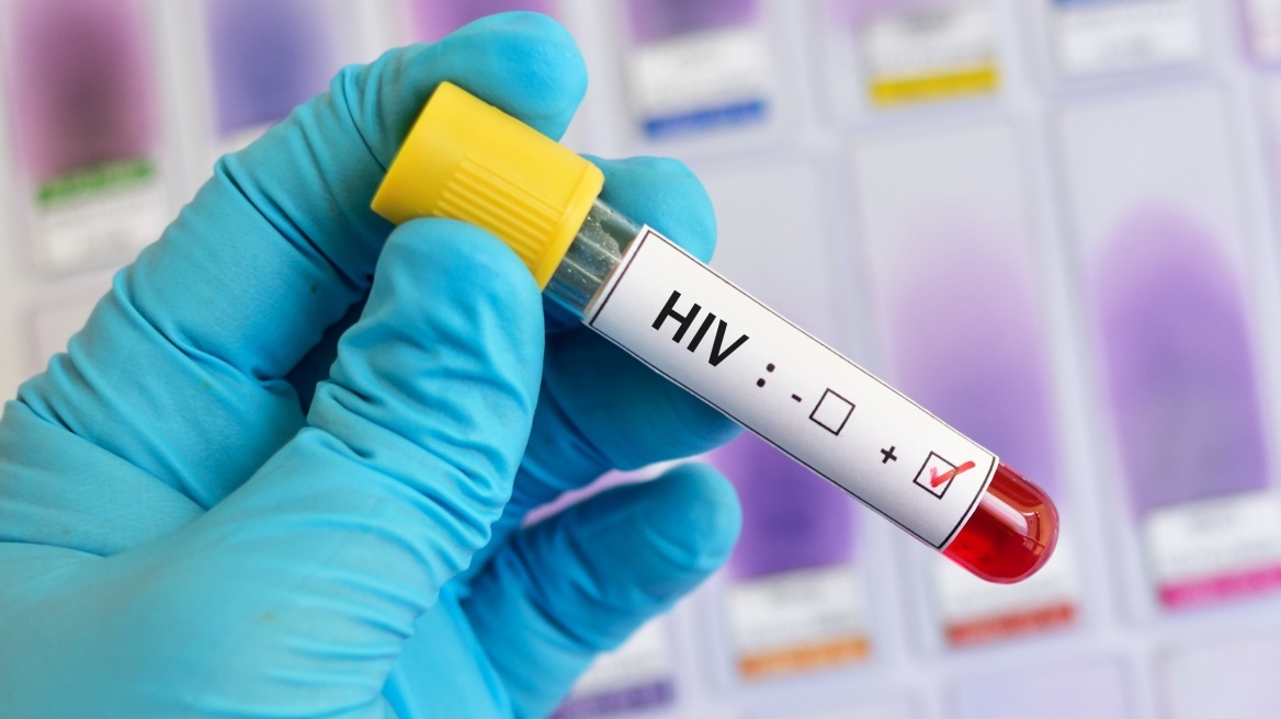 HIV: Ένας στους πέντε που ζει με τον ιό δεν το γνωρίζει και δεν λαμβάνει θεραπεία 