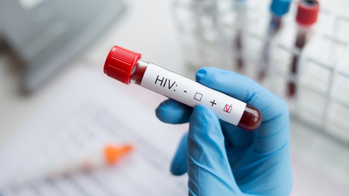 Λοίμωξη HIV: Μείωση των κρουσμάτων στην Ελλάδα το 2022