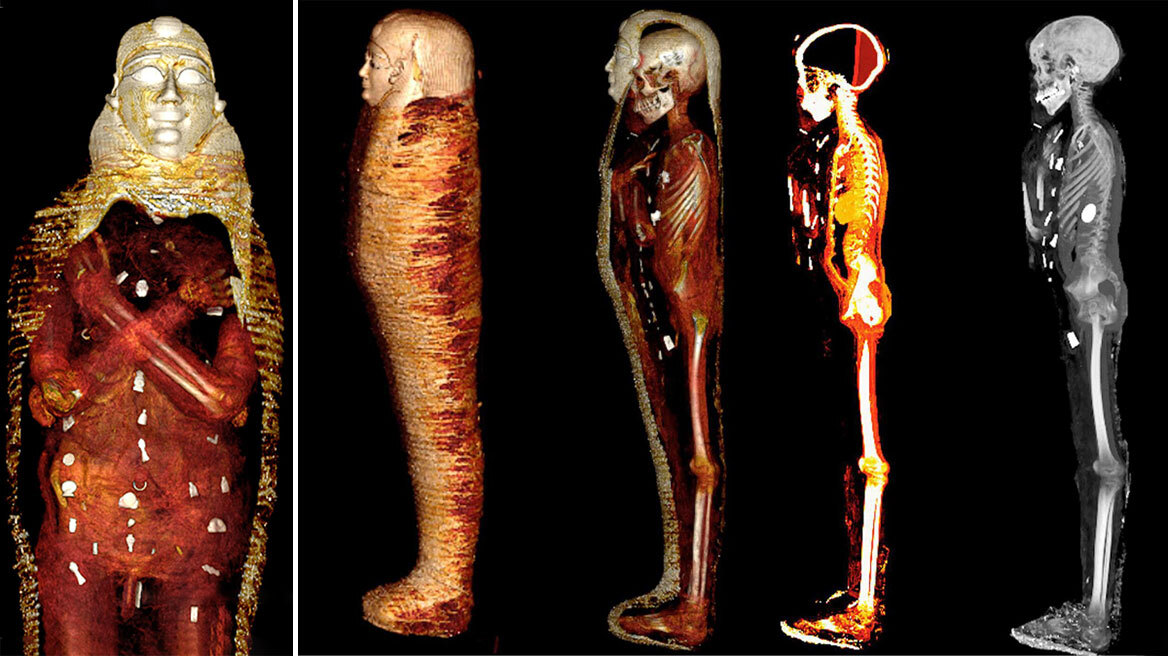 Η μούμια του «Χρυσού Αγοριού» αποκαλύπτει τα μυστικά της και τα 49 κρυφά φυλαχτά της