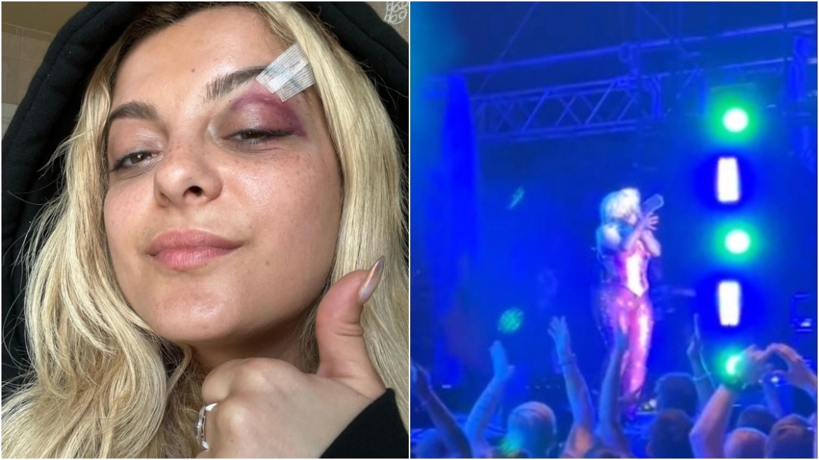 Bebe Rexha: Ο άνδρας που τη χτύπησε στο πρόσωπο με το κινητό αποκάλυψε γιατί το έκανε - «Σκέφτηκα ότι θα ήταν αστείο»