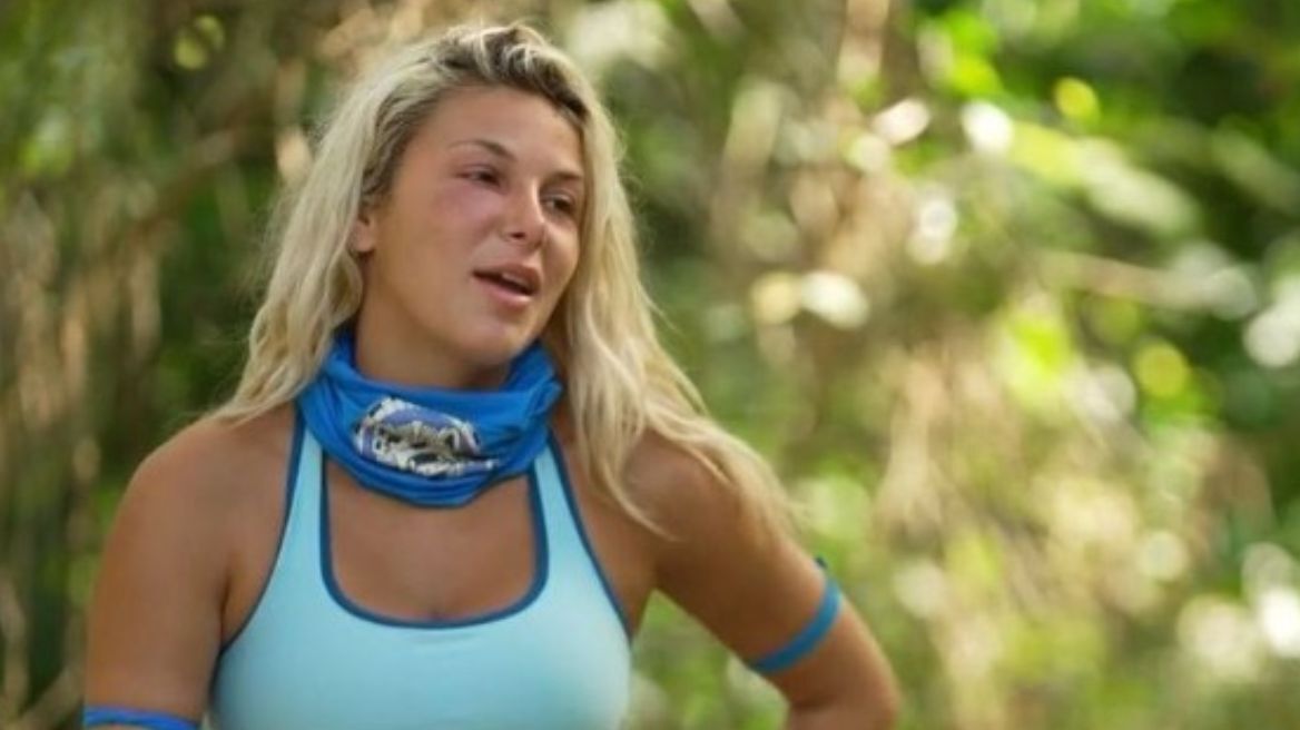 Survivor: Πρήστηκε το πρόσωπο της Χρύσας - Την τσίμπησε έντομο στο οποίο είναι αλλεργική