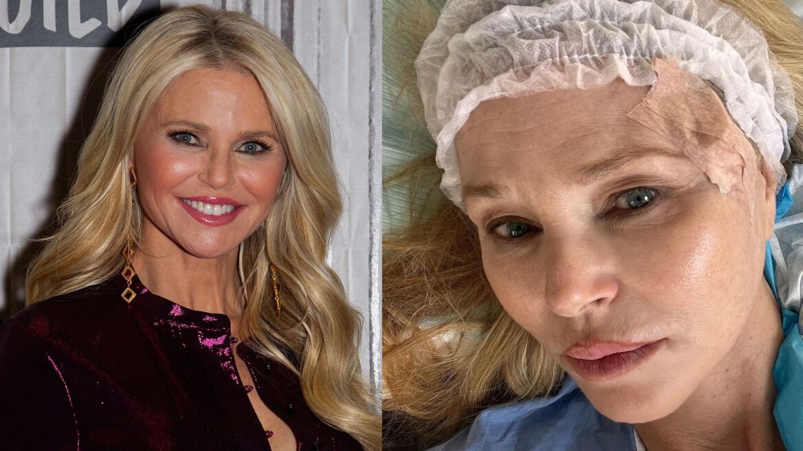 Christie Brinkley: Το μοντέλο διαγνώστηκε με καρκίνο του δέρματος