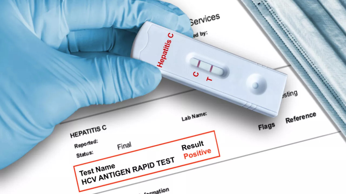 Το πρώτο self test για την ανίχνευση του ιού της Ηπατίτιδας C