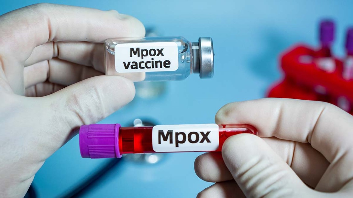 Mpox: 18 επιβεβαιωμένα κρούσματα του ιού στην Ελλάδα τον Νοέμβριο και τον Δεκέμβριο