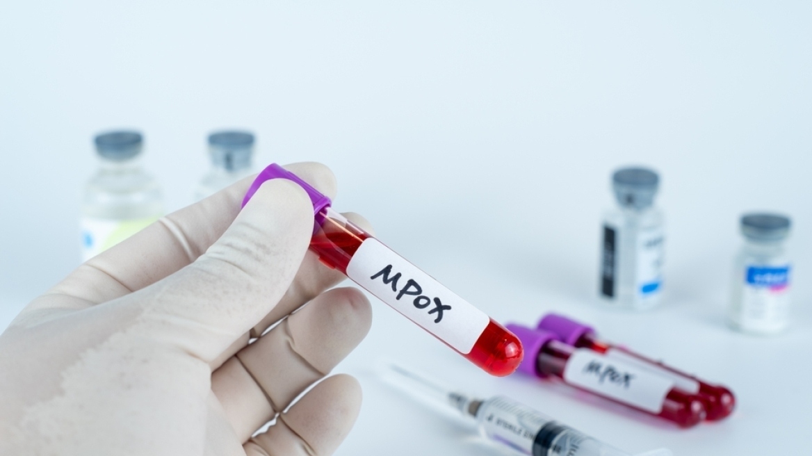 Συναγερμός για τον mpox στη Γαλλία -  Εντοπίστηκε για πρώτη φορά η νέα παραλλαγή clade 1b 