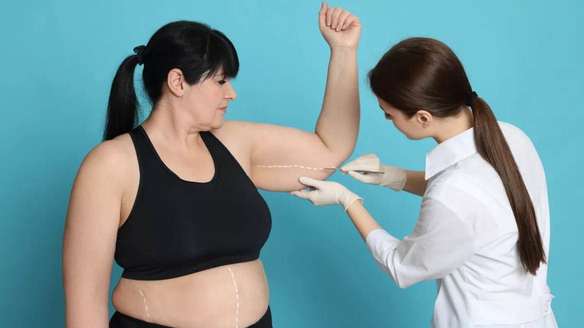 Παχυσαρκία: Οι 2 πιο αποτελεσματικές επεμβάσεις βαριατρικής χειρουργικής – Τι πρέπει να ξέρουμε