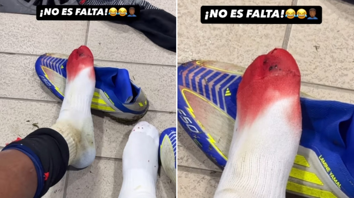 Γιαμάλ: «Κι όμως αυτό δεν είναι φάουλ» - Το αιματηρό χτύπημα που ξεσήκωσε αντιδράσεις