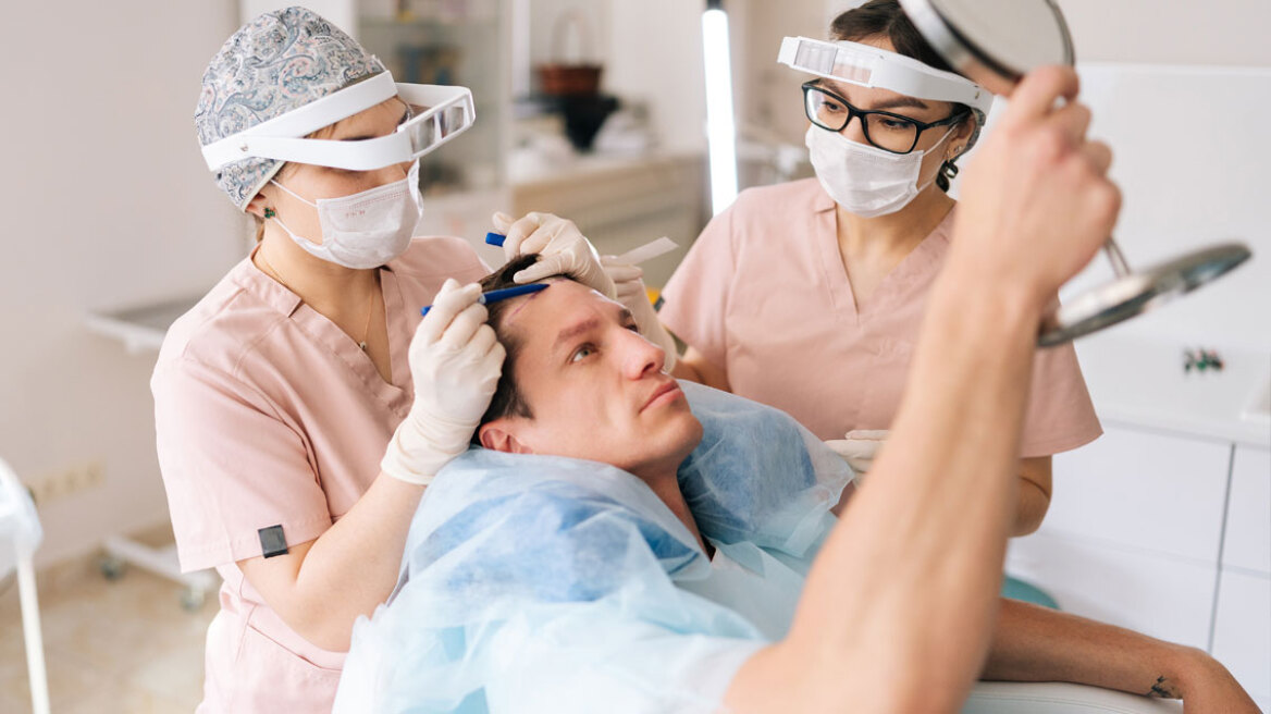 Πώς η Τουρκία έγινε ο παράδεισος της μεταμόσχευσης μαλλιών – Οι τιμές