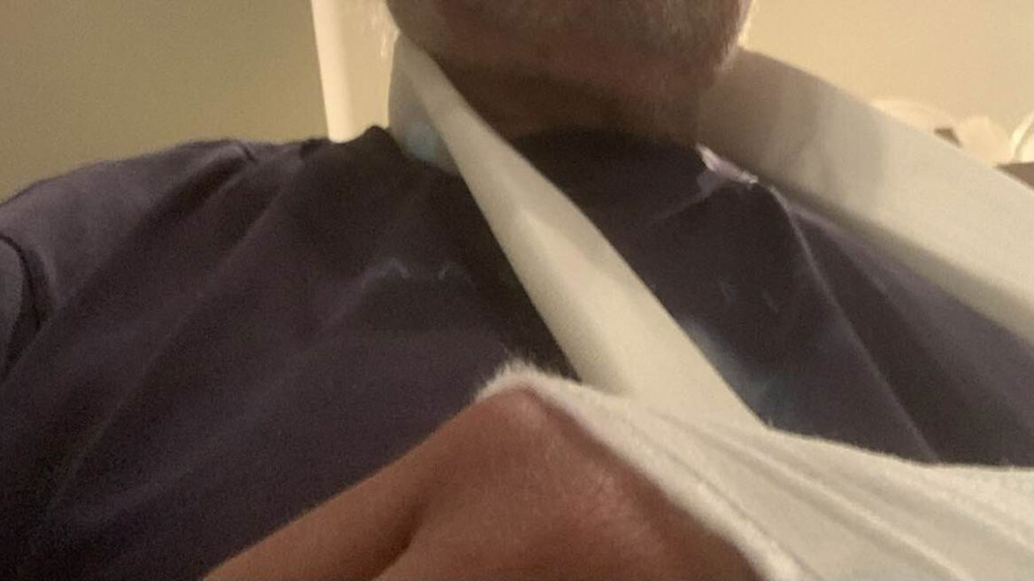 Με κατάγματα ο Άκης Τσελέντης - Πήγε να σώσει γλάρο και τραυματίστηκε