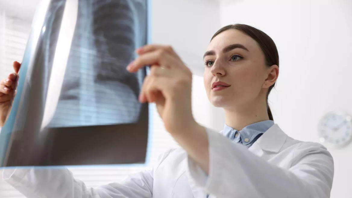 Φυματίωση: Συναγερμός στην Ευρώπη – Αύξηση 10% στα παιδιά