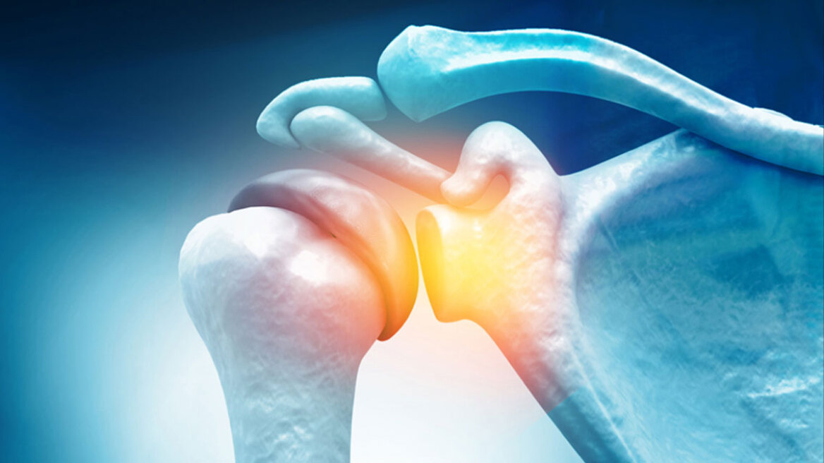 Αρθροπλαστική ώμου με Σύστημα Πλοήγησης Επαυξημένης Πραγματικότητας