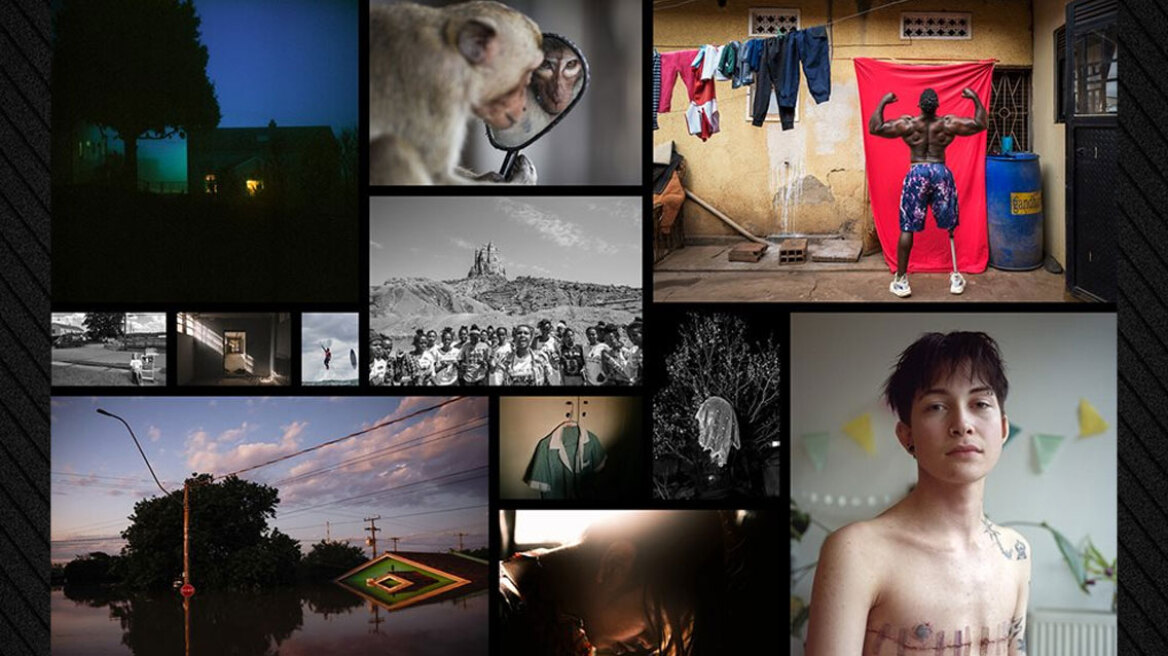 World Press Photo: Πρώτο βραβείο στη φωτογραφία ενός 9χρονου Παλαιστίνιου  ακρωτηριασμένου και από τα δύο χέρια