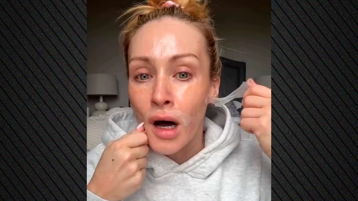 Σάλος με μάσκα «skincare»: Influencer «σφάδαζε» απ' τον πόνο κατά την αφαίρεση της